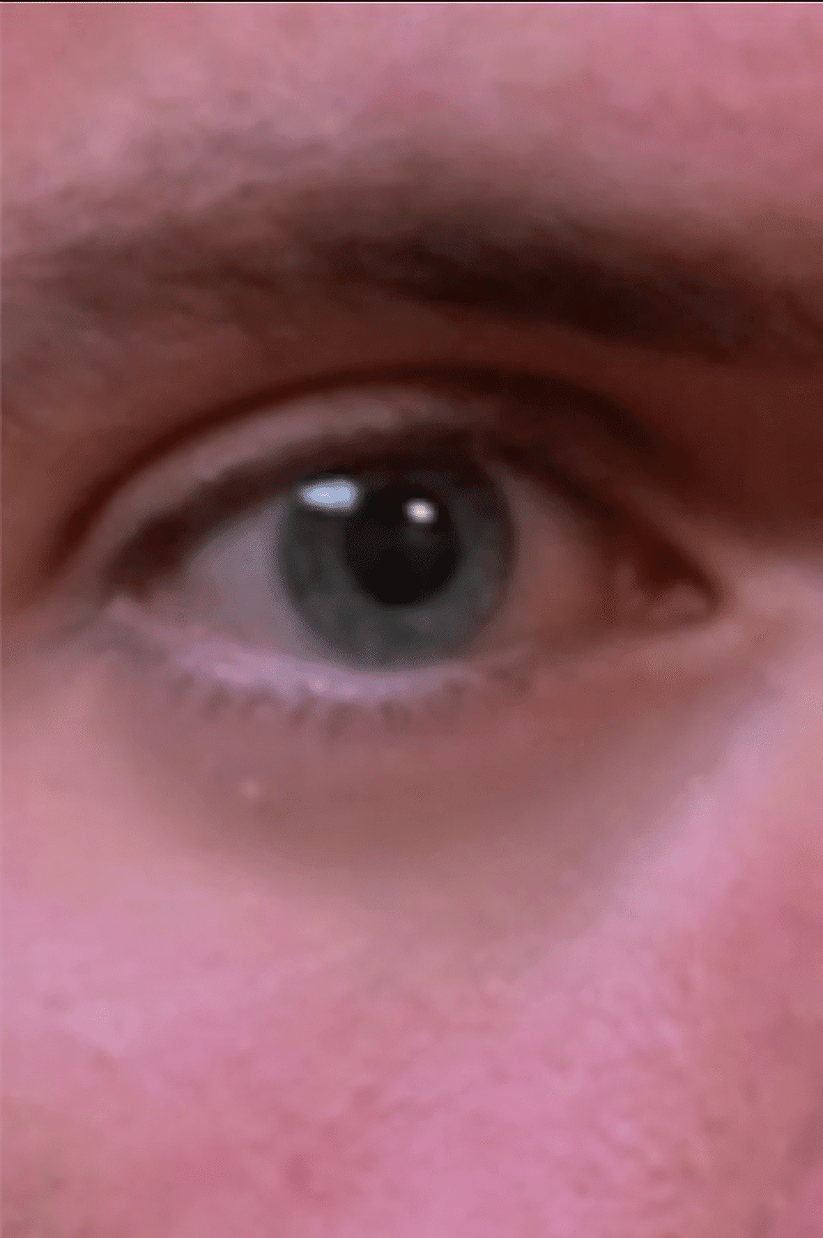 augenringeliftgamma digital production