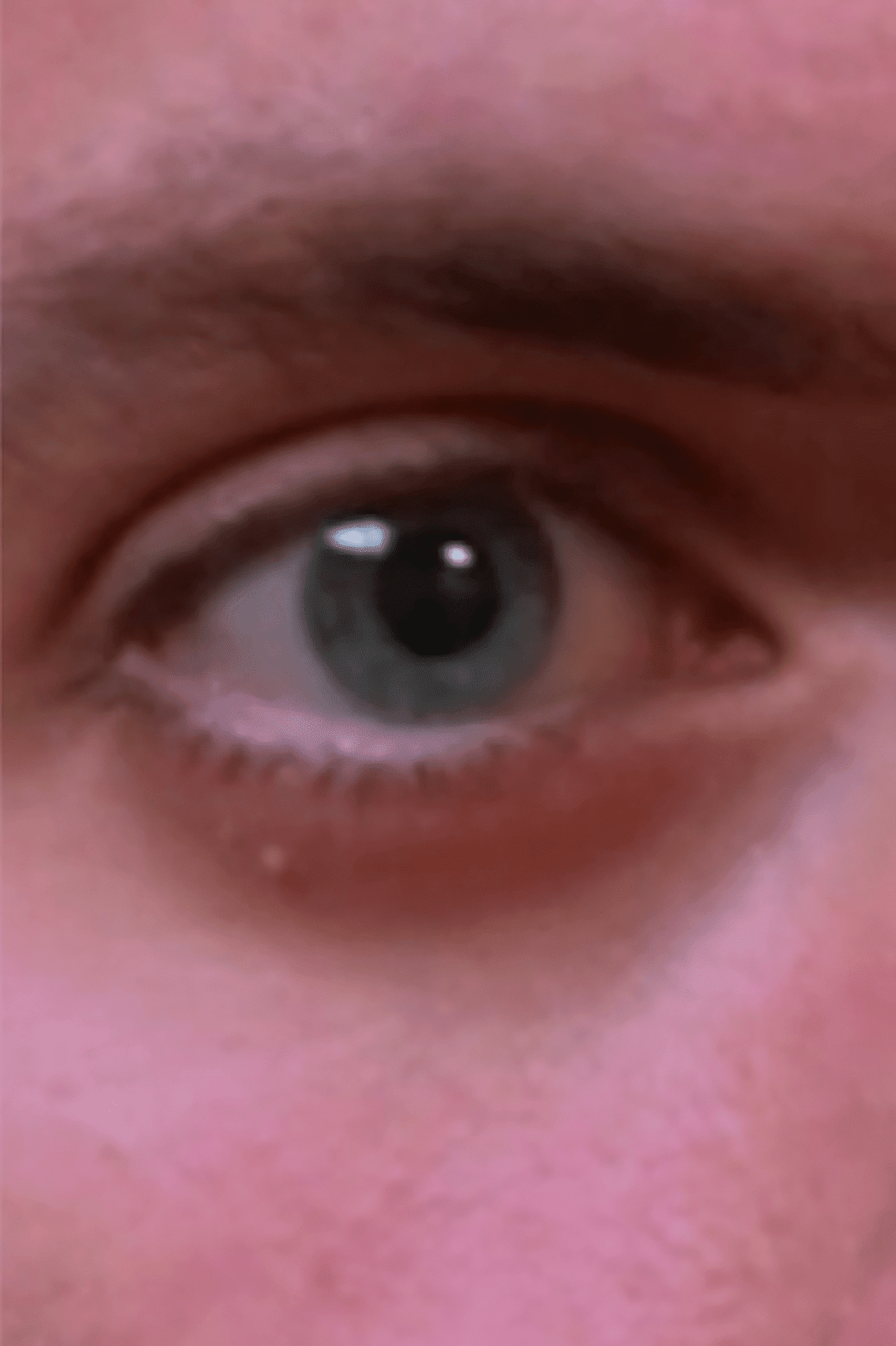 augenringevorher digital production