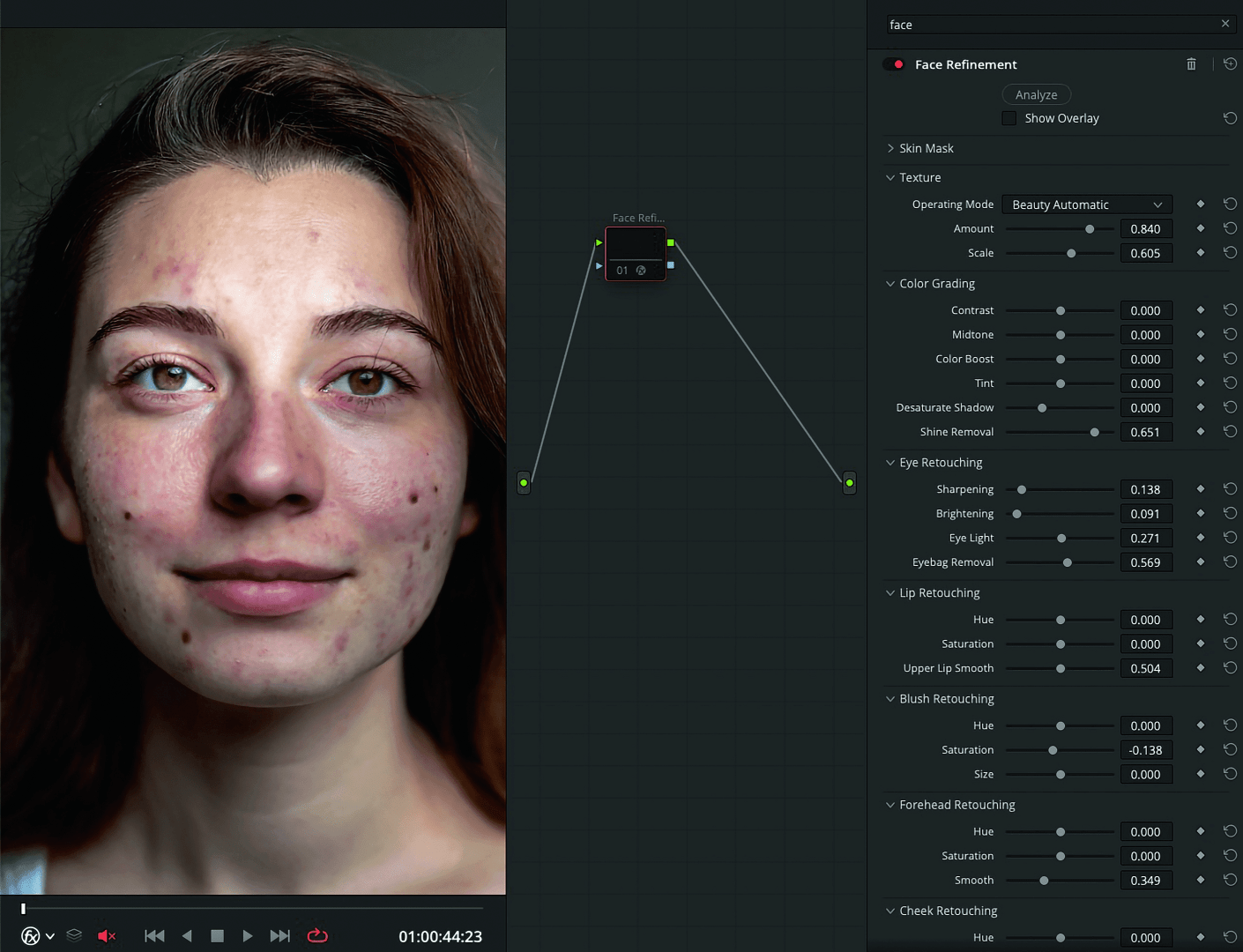 facerefinementvorher4k digital production